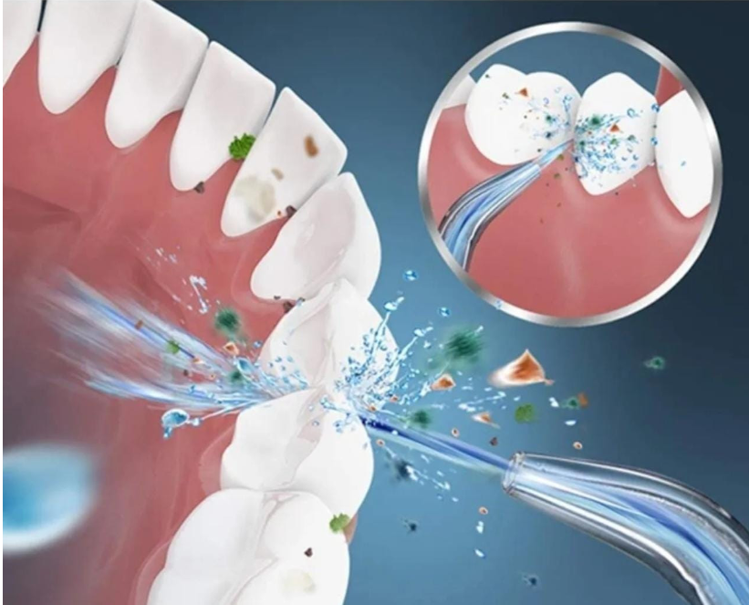LIMPIADOR DENTAL RECAGABLE IRRIGADOR- SALUD