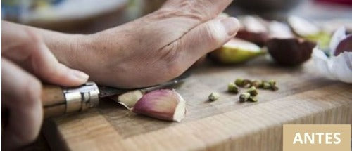 PRENSA DE AJO PROFESIONAL - HOGAR Y COCINA 🧅✨